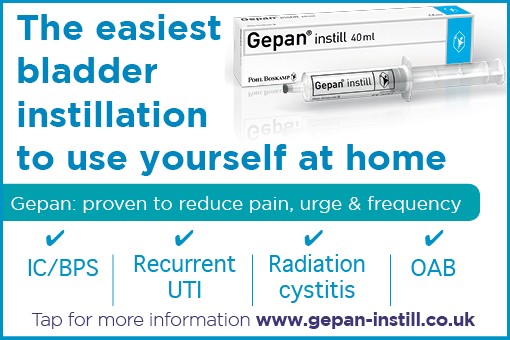Gepan